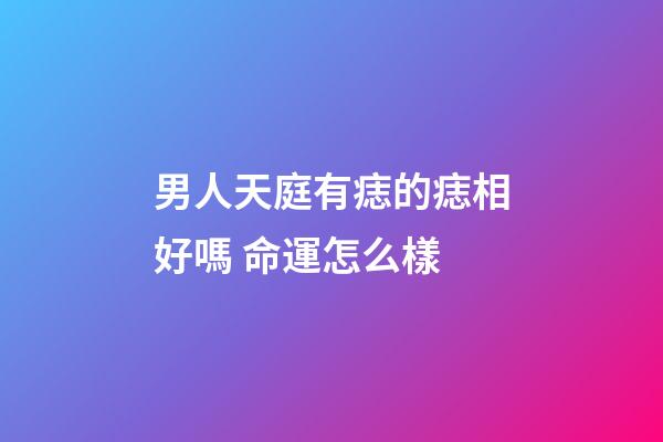 男人天庭有痣的痣相好嗎 命運怎么樣